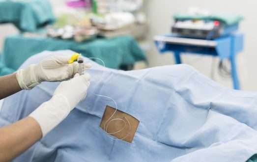 Study: CSF proteome profiling reveals highly specific biomarkers for dementia with Lewy bodies. Image Credit: ChaNaWiT/Shutterstock.com