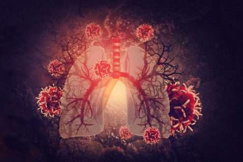 مطالعه تجزیه و تحلیل جامعی از تغییرات باکتریایی و قارچی در COVID-19 ارائه می دهد