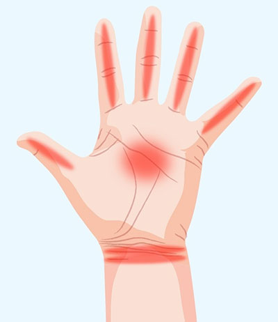 دست شما در مورد سلامت بدنتان چه می‌گوید؟