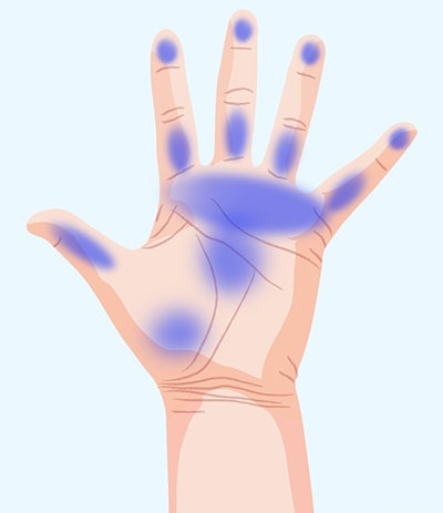دست شما در مورد سلامت بدنتان چه می‌گوید؟