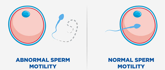 ۱۶ مورد در آزمایش اسپرم و تفسیر آنلاین آن