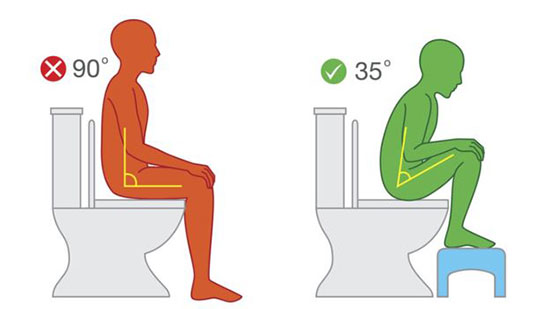 کدام توالت برای سلامتی ما بهتر است؛ فرنگی یا سنتی؟