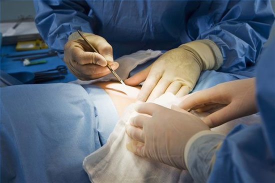 آیا عمل دیسک کمر خطرناک است؟